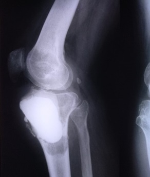 oncology img