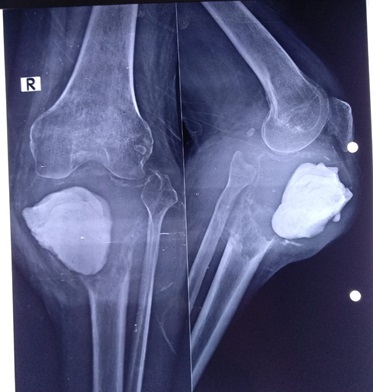 oncology img