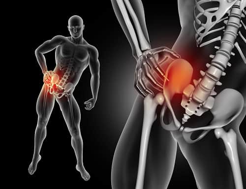 hip replacement